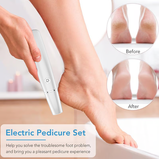 🔥Kuuma Myynti - 50% POIS🔥Electric Feet Callus Remover⚡