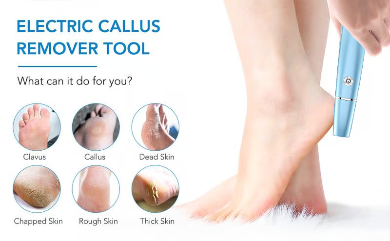 🔥Kuuma Myynti - 50% POIS🔥Electric Feet Callus Remover⚡