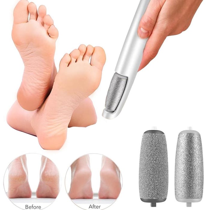 🔥Kuuma Myynti - 50% POIS🔥Electric Feet Callus Remover⚡